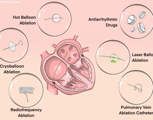 Ablation therapies for paroxysmal atrial fibrillation: A systematic review and patient-level network meta-analysis