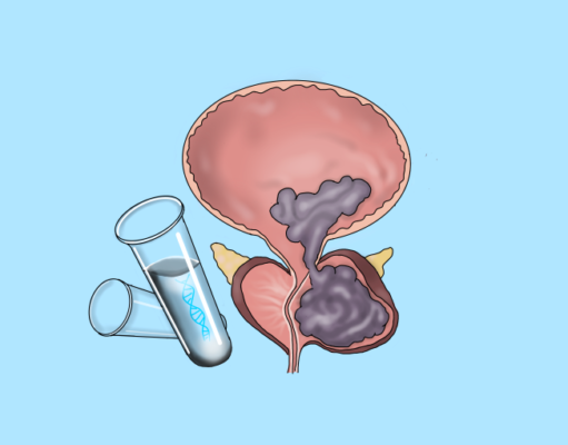 An approach to genetic testing in patients with metastatic castration-resistant prostate cancer in Singapore