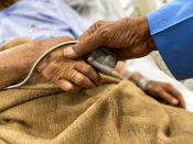 Impact of an ageing population on the intensive care unit