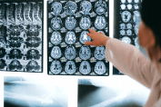 Transforming radiology to support population health