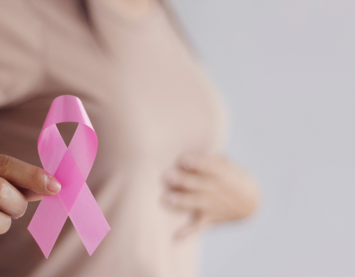 Breast cancer-related lymphedema (BCRL): Should we be doing more or less for the axilla?