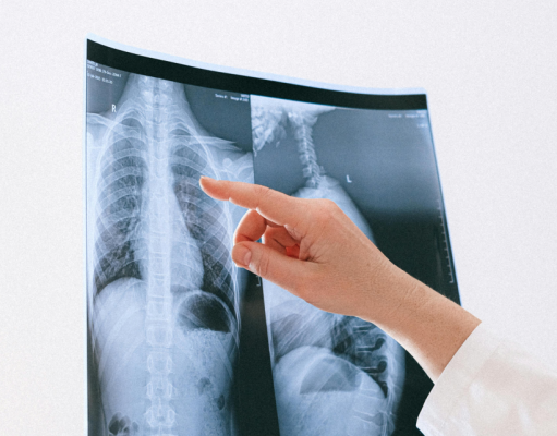 Singapore tuberculosis (TB) clinical management guidelines 2024: A modified Delphi adaptation of international guidelines for drug-susceptible TB infection and pulmonary disease
