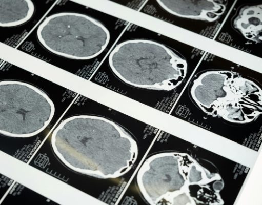 MRI landscape in Southeast Asia