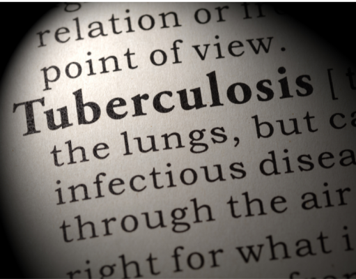 Recommendations for screening for latent tuberculosis infection in people with rheumatic diseases: Consensus statement from the Singapore Chapter of Rheumatologists
