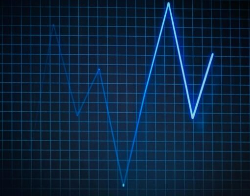 Association of estimated pulse wave velocity with 28-day mortality in sepsis: A MIMIC-IV study